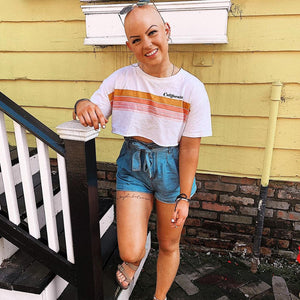 Emmy: Feeling Beautiful with Alopecia